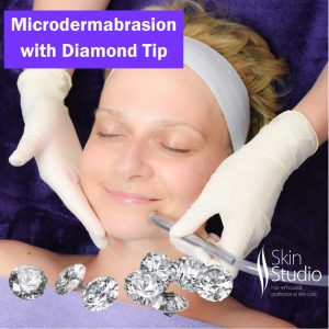 diamond microdermabrasion